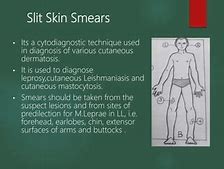 Slit Skin Smear Cara Kerjanya